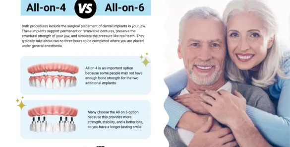 all on 4 vs all on 6 dental implants